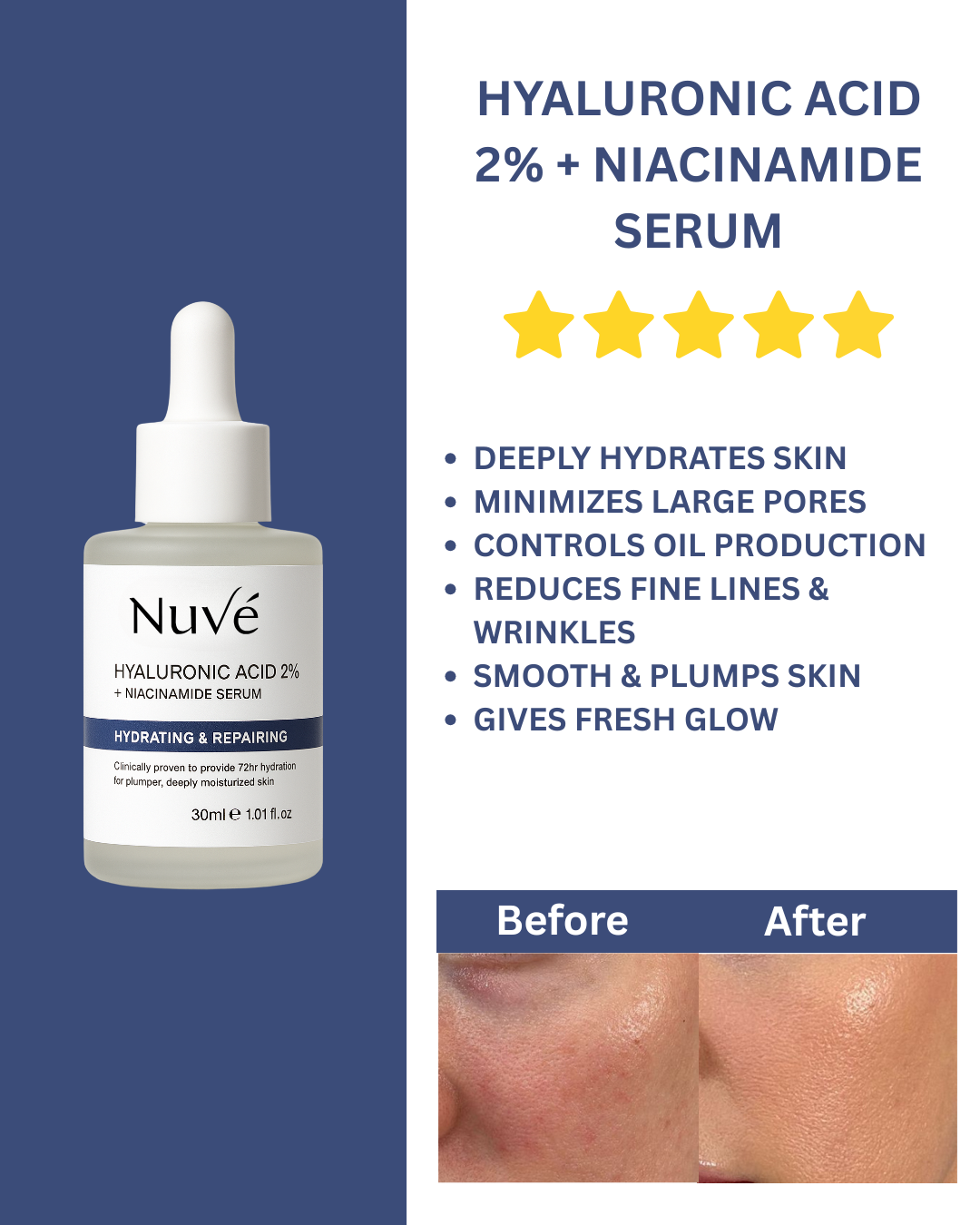 HYDRATING & REPAIRING SERUM - Hyalournic Acid + Niacinamide