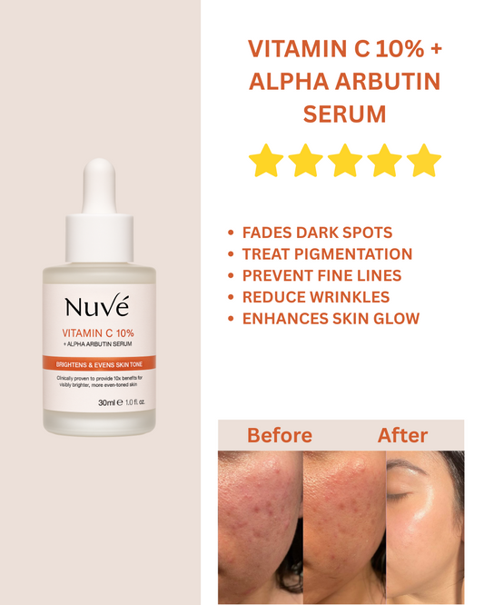 VITAMIN C 10% + ALPHA ARBUTIN SERUM