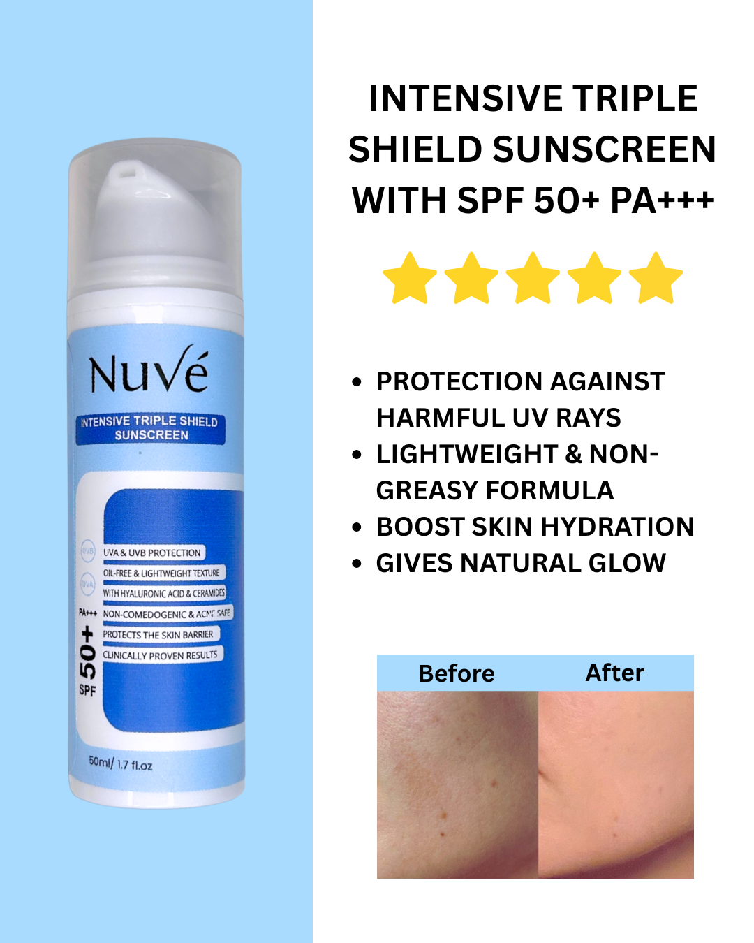 Nuve International